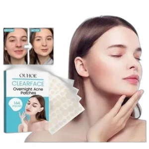 PARCHES ANTIACNE MOCMALLURE